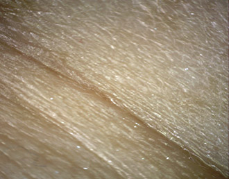 Improvement of the microrelief
