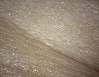 Improvement of the microrelief